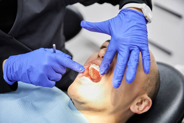 Best Knocked-Out Tooth (Avulsed Tooth) Treatment in Port Morris, NJ