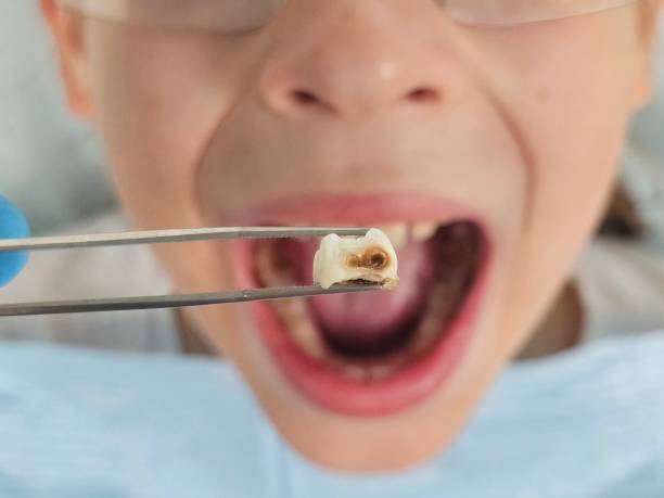 Best Emergency Treatment for Jaw Pain or Injury in Port Morris, NJ